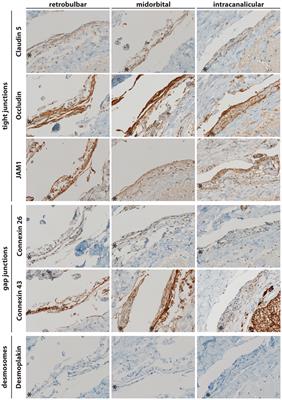 Cell–Cell Interaction Proteins (Gap Junctions, Tight Junctions, and Desmosomes) and Water Transporter Aquaporin 4 in Meningothelial Cells of the Human Optic Nerve